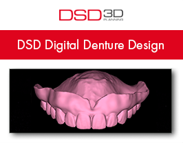 digital_denture_design