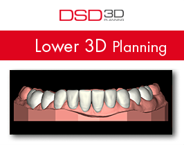 lower_3d_planning